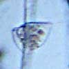 20090308_2020_Rotifer.jpg