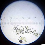 20090318_0033_BacteriaKillingAlgae.jpg