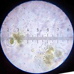 20090318_0043_BacteriaKillingAlgae.jpg