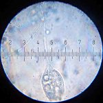 20090322_0206_Vorticella.jpg