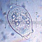20090322_0210_Vorticella-Telotroch.jpg