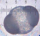 20090321_2216_3CellAlgae.jpg