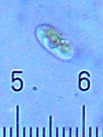 20090324_0258_Cyanobacteria.jpg