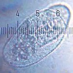 20090326_0056_Paramecium.jpg