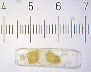 20090328_0142_Bacterium.jpg